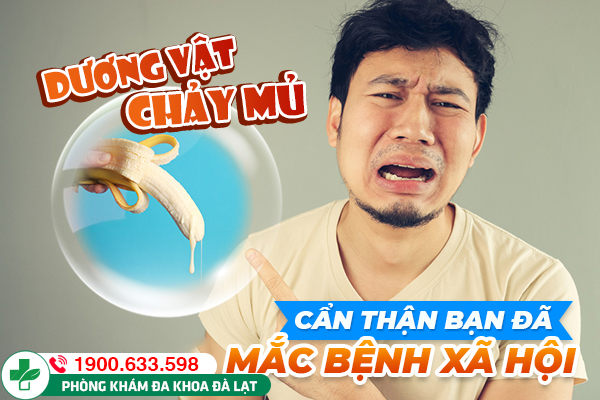 Hình ảnh minh họa